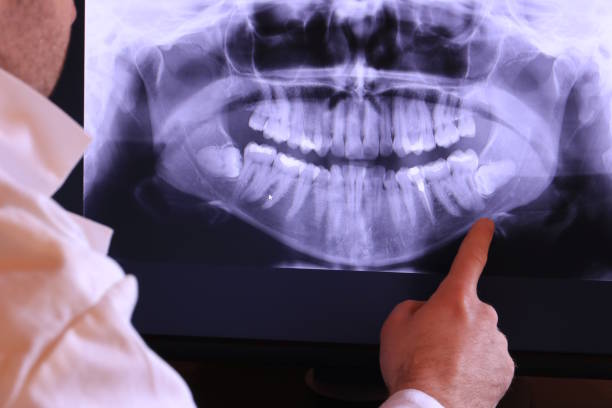 Best Emergency Root Canal Treatment in Prosperity, WV