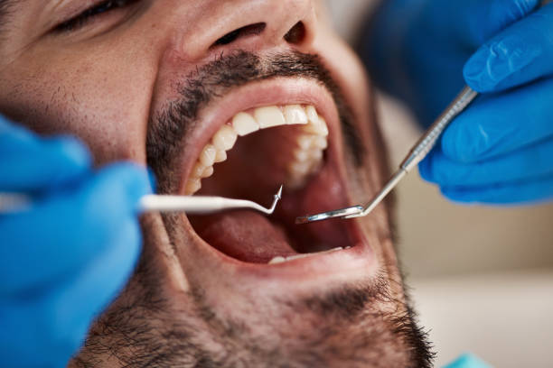 Best Emergency Dental Extractions in Prosperity, WV