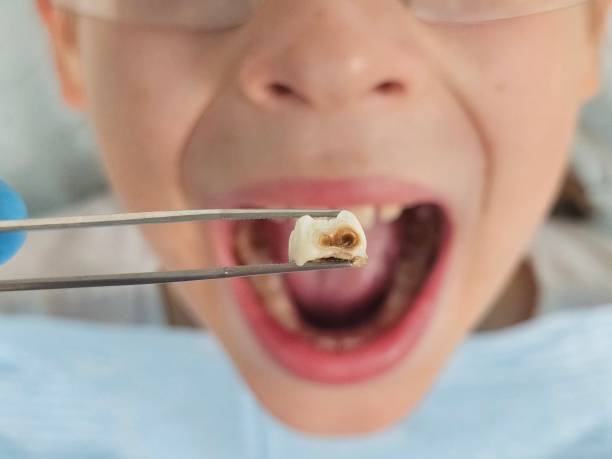 Best Mobile Emergency Dentist in Prosperity, WV